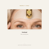 Where the EMSTIGHT forehead patch is worn — the single wide hydrogel patch placed across the brow